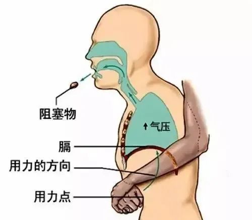 生活小妙招，应对吃饭噎着的紧急处理办法